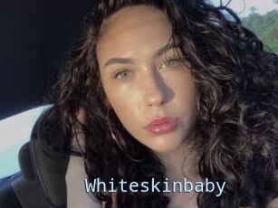 Whiteskinbaby